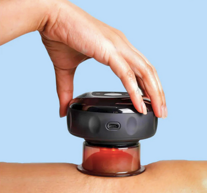 PulseCup - Smart Cupping Massager